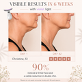 MALLOW EMS Face Beauty